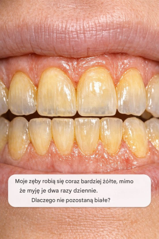 Moje zęby robią się coraz bardziej żółte, mimo że myję je dwa razy dziennie. Dlaczego nie chcą pozostać białe?