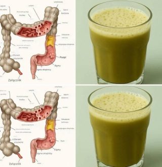 Naturalny sok, który oczyszcza jelita, usuwając kilogramy toksyn i mas kałowych.