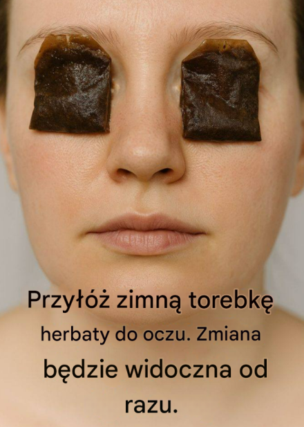 Przyłóż zimną torebkę herbaty do oczu. Zmiana będzie widoczna od razu.