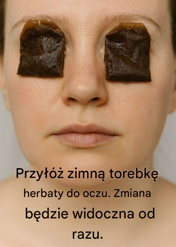 Przyłóż zimną torebkę herbaty do oczu. Zmiana będzie widoczna od razu.
