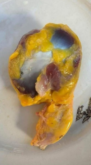 Dlaczego warto jeść żołądki kurczaka?