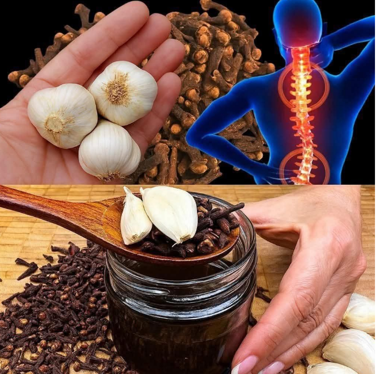 Pożegnaj bóle stawów, artretyzm i reumatyzm w zaledwie 3 dni! Odkryj skuteczną formułę z goździkami i czosnkiem.