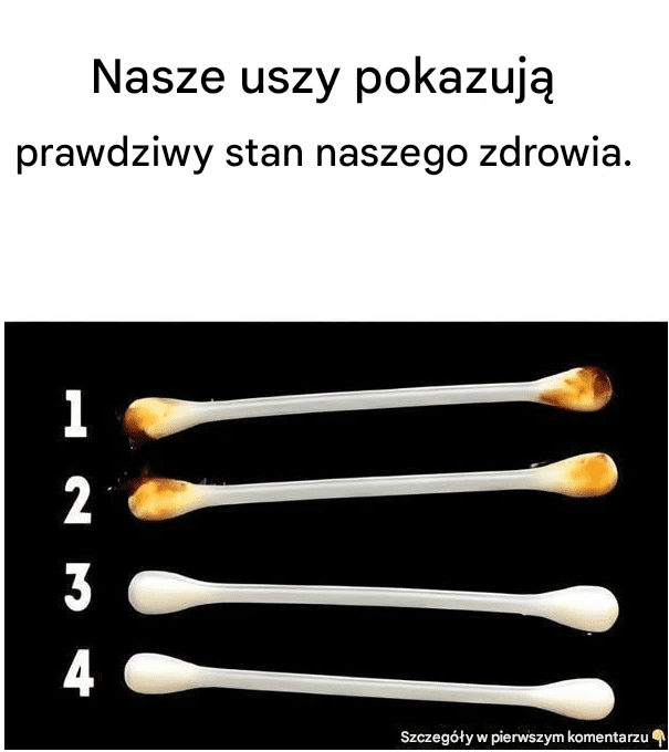 Nasze uszy pokazują prawdziwy stan naszego zdrowia.