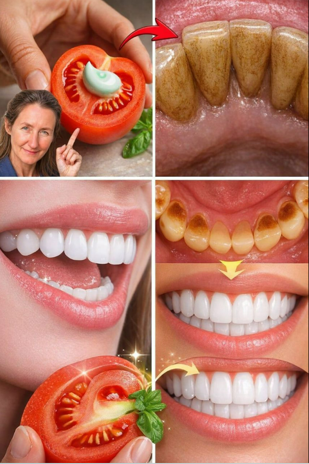Sekret olśniewającego uśmiechu: wybiel zęby w domu za pomocą pomidora i pasty do zębów