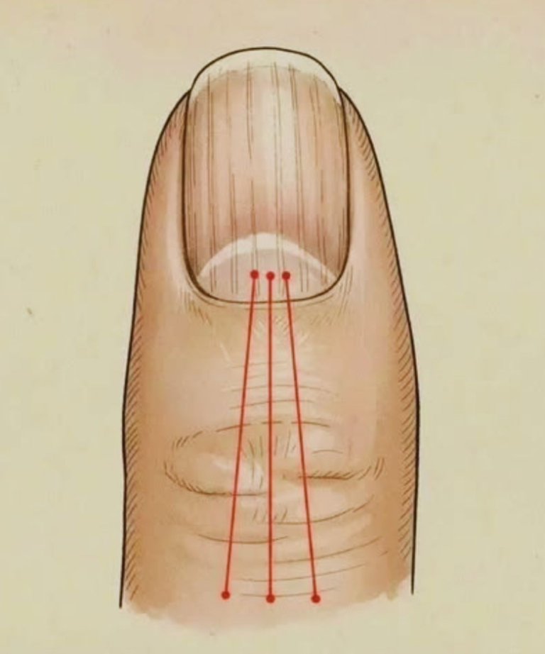 Co jeść, aby zmniejszyć bruzdy na paznokciach: poradnik żywieniowy dla zdrowszych paznokci