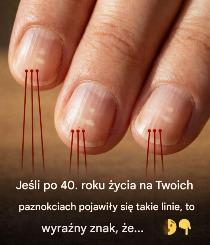 Produkty spożywcze, które wzmacniają paznokcie po 40. roku życia