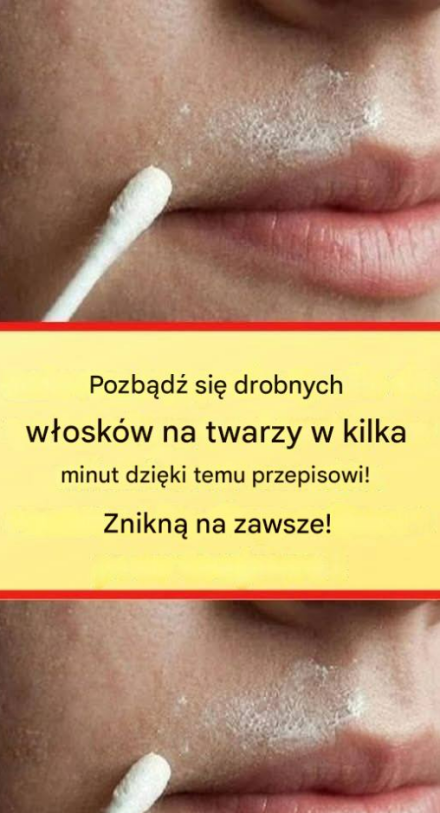 Ten naturalny przepis trwale usunie włosy z twarzy